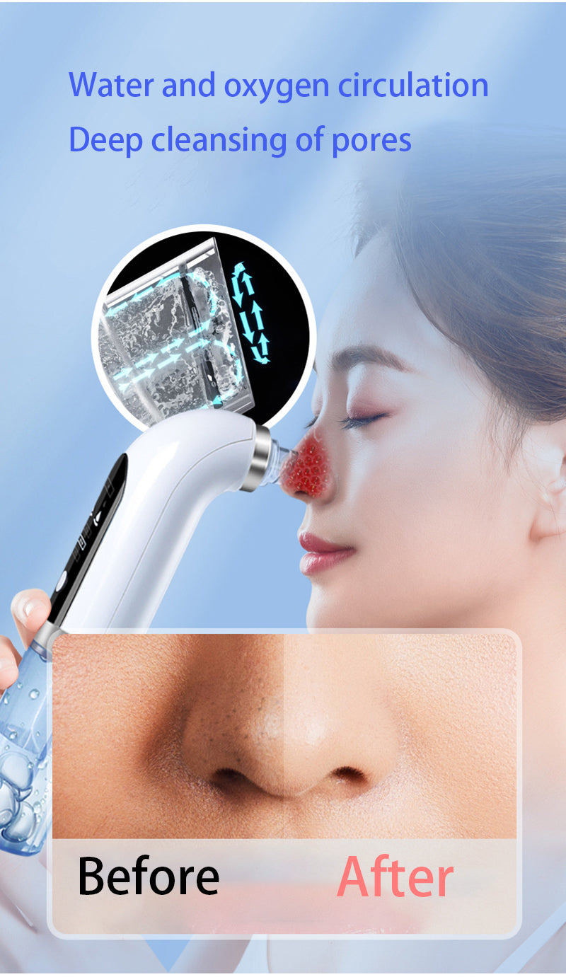 Blackhead Remover Pore Vacuum Cleaner